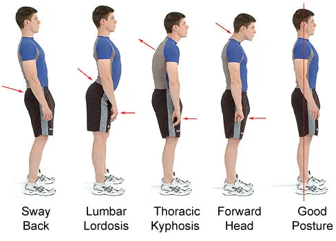 The Posture Arch